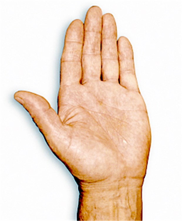Ist wenn rechte hand juckt was die Eindeutige Diagnose: