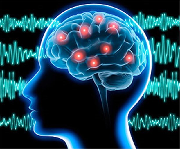 Neurologen fordern Neurologen Die Hirntoddiagnostik ist in Deutschland eine der sichersten Diagnosen in der Medizin, so Neurologen.