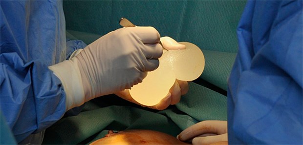 Nur mäßige Hoffnung für betroffene Frauen Die Implantate des Herstellers Poly Implant Prothèse wurden weltweit zehntausendfach verkauft.