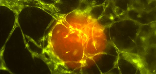 Mit 3D-Drucker auf den Spuren der Karzinogenese Die Innsbrucker Forscher lassen eine rot fluoreszierende Tumorsphäre in biogedrucktem Gewebe wachsen.