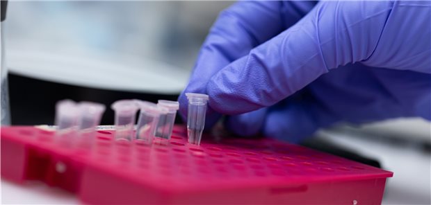 Die KBV will die Abwertung der PCR-Tests nicht hinnehmen.