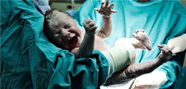 Die Kaiserschnittentbindung im Fokus: Gibt man Müttern die Antbiotikaprophylaxe erst nach Abnabelung, kann das Vorteile für das kindliche Mikrobiom haben (Symbolbild).