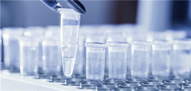 Die Laborärzte warnen davor, PCR-Tests ohne Anlass für Jedermann zu versprechen.