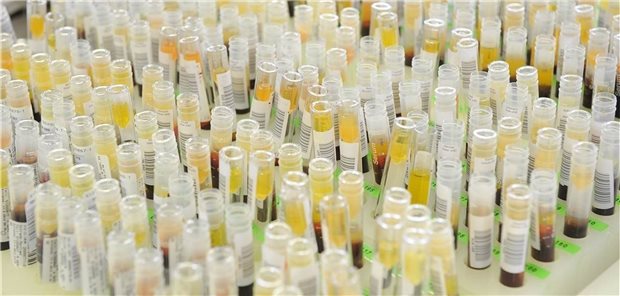 Labore fordern PCR-Priorisierung Die Labore laufen allmählich über: Omikron lässt die PCR-Nachfrage rasant steigen.
