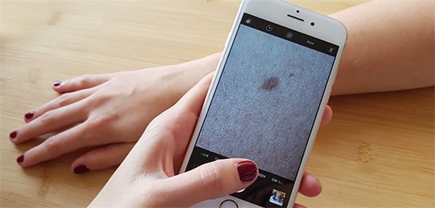 Diagnose von Hautflecken per Smartphone Die Landesärztekammer Baden-Württemberg hat jetzt den Antrag für die erste teledermatologische Smartphone-Anwendung – AppDoc – genehmigt.