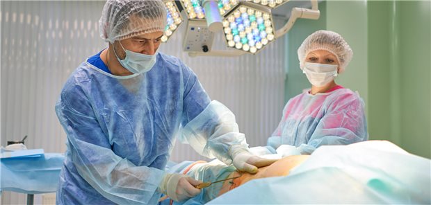 Die Liposuktion