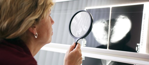 Mammografie funktioniert - ein bisschen Die Mamma im Blick.