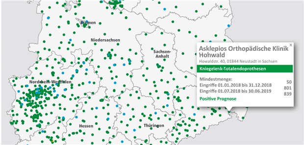 1083 Kliniken mit positiver Prognose Die Mindestmengen-Karte im Internetauftritt der AOK zeigt: An 952 Krankenhaus-Standorten in Deutschland dürfen nächstes Jahr Implantationen von künstlichen Kniegelenken durchgeführt werden.
