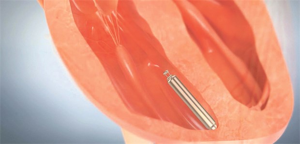 Die Mini-Taktgeber können per Katheter direkt ins Herz vorgeschoben und dort befestigt werden.