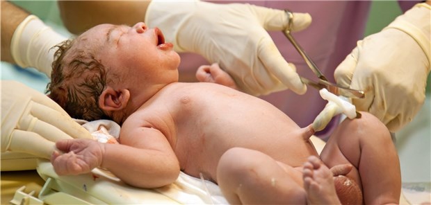 Die: Nabelschnur wird durchschnitten: Aber halt, nicht entsorgen! Gewebe aus der Nabelschnur könnte Diabetes-Kranken mit Fußulzera bei der Therapie nutzen.