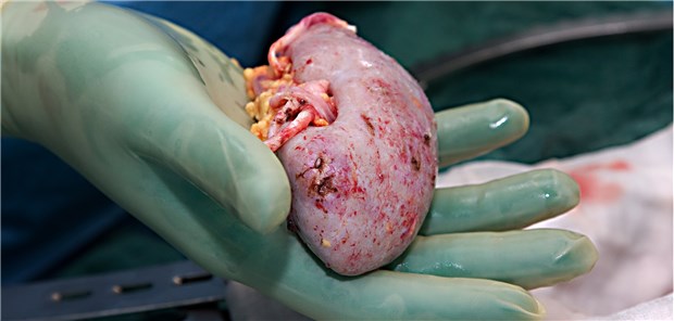 Zuspruch steigt – Spenderzahlen sinken Die Niere ist das Spenderorgan, das am häufigsten benötig wird. © Horizont21 / fotolia.com