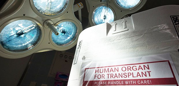 Ist eine Strukturreform nötig? Die Organtransplantation steht zurzeit in keinem guten Licht.