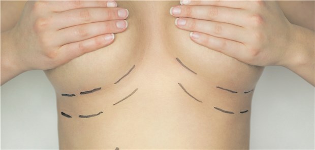 EU-Bürgerinnen diskriminiert? Die PIP-Implantate beschäftigen weiterhin Gerichte.