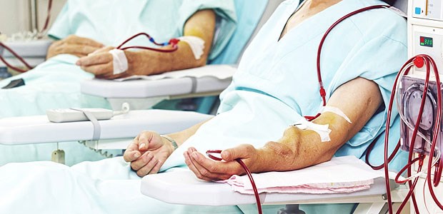 Runter mit den Dialysepauschalen! Die Pauschalen für die Dialyse werden gesenkt.