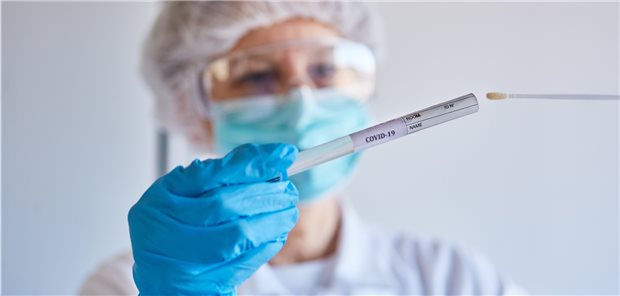 Labormediziner rechnen mit wenigen Corona-Mutationen bei PCR-Screenings Die Probe für die Analyse nach dem Abstrich: Ist sie positiv, testen derzeit viele Fachlabore auch auf SARS-CoV-2-Mutationen.