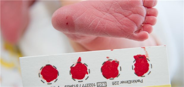 Die Probenentnahme für das ENS soll zwischen der 36. und 72. Lebensstunde erfolgen, sofern die Eltern der Untersuchung zustimmen.