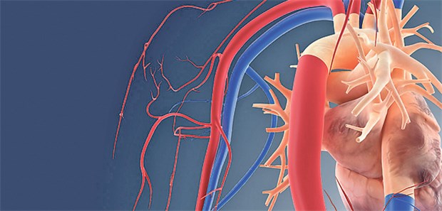 Die Prognose beim Marfan-Syndrom bestimmt unter anderem das Aortenwurzelaneurysma.