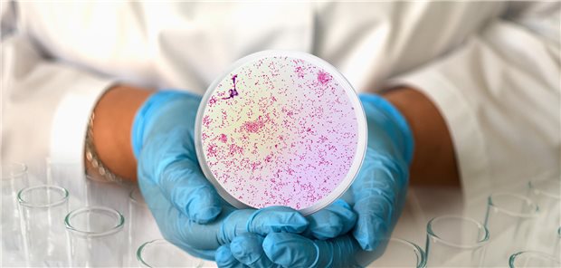 Eine Frau hält einen Abstrich von Gonokokken in die Kamera.