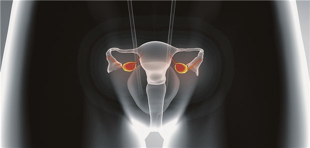 Die Rationale hinter der hyperthermischen Behandlung bei Ovarial-Karzinom ist die Beobachtung, dass die hohe Temperatur das Eindringen des Chemotherapeutikums in das Peritoneum erleichtert.