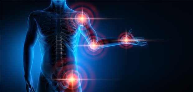 Die Rheumatologie bietet Forschern allerlei Anknüpfungspunkte für neue Wissenschaftsprojekte. Das gilt auch für die Versorgungsforschung.