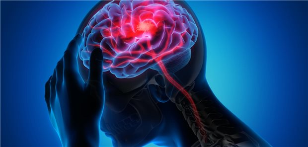 Die Schlaganfall-Prävalenz ist in den Jahren 2017 bis 2022 in der Gesamtbevölkerung mehr oder weniger konstant geblieben.