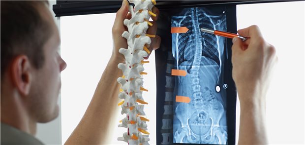 Die Skoliose-Therapie wird festgelegt. Ohne Bildgebung geht es bei dieser Erkrankung nicht.