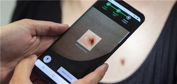Die Smartphone-App von Derm.AI fotografiert verdächtige Flecken auf der Haut mit genau definierten und standardisierten Einstellungen.