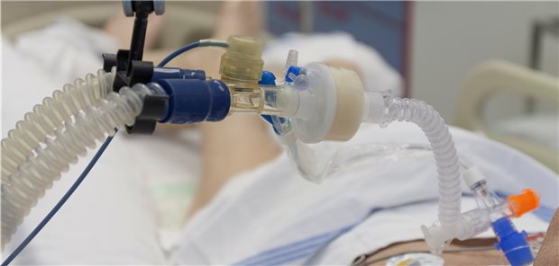 Sterberate bei COVID-19 deutlich gesunken Die Sterberate bei schwer erkrankten COVID-19-Patienten ist deutlich gesunken, berichten US-Forscher.