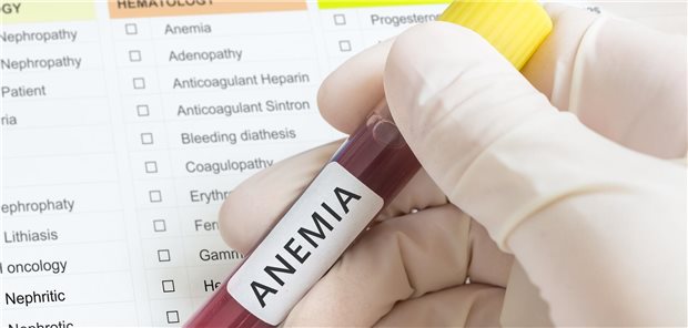 Die Hand eines Forschers hält ein Reagenzglas mit einer Blutprobe für einen Anämie-Test.