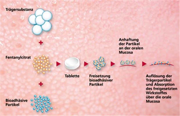 Die Sublingualtablette zerfällt bei Speichelkontakt. Bioadhäsive Partikel bleiben an der Mundmucosa haften, sodass Fentanyl über die Mucosa resorbiert wird. © Arzneimittel ProStrakan / photos.com