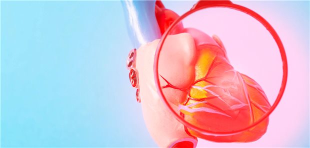 Medizinische Attrappe des Herzens eines Patienten/einer Patientin die an einer Herzmuskelentzündung leider unter einer Lupe auf einem blauen Hintergrund.