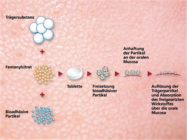 Die Tablette Abstral® enthält mikronisiertes Fentanylcitrat.