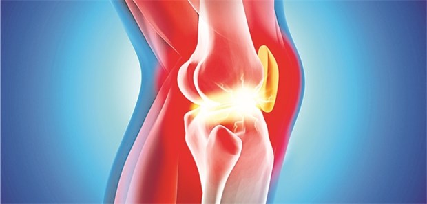 Die Therapie bei Kniearthrose zielt vor allem darauf ab, die Alltagsaktivitäten günstig zu beeinflussen.