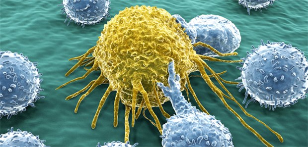 Mit Viren gegen Krebs Die Therapie stimuliert die Abwehrkräfte: T-Lymphozyten attackieren eine Krebszelle.