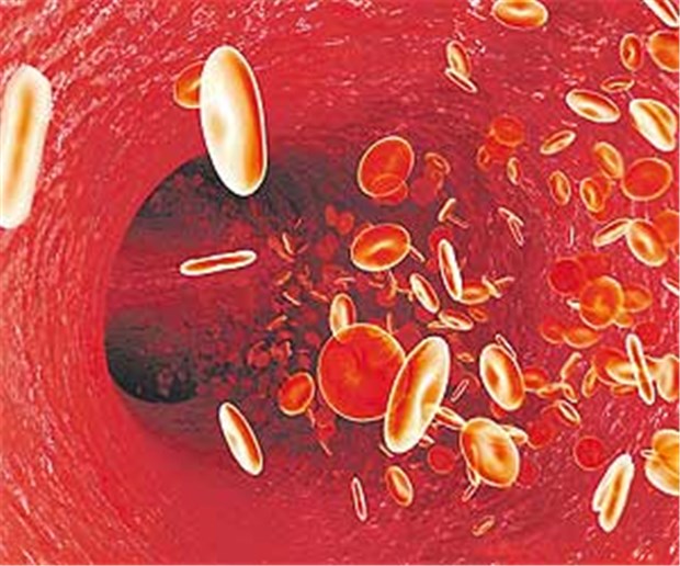 Späte Thromboseprophylaxe kostet Leben Die Thrombosegefahr ist bei Intensivpatienten hoch.
