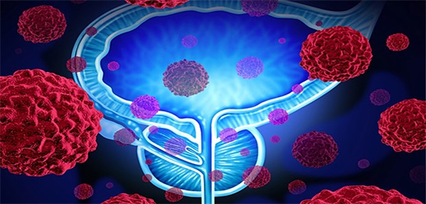 Niedriggradiges Prostata-Ca: Überwachen oder intervenieren? Die Tumorbiologie des Prostatakarzinoms unterscheidet sich deutlich von der anderer Karzinome. Das hat auch Einfluss auf Therapieentscheidungen.