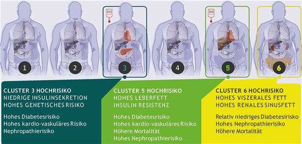 Die Typen unterscheiden sich deutlich bei den Risiken für Krankheitsentstehung und Folgekrankheiten.