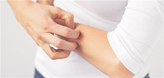 Die Ursachen von Juckreiz können vielseitig sein.