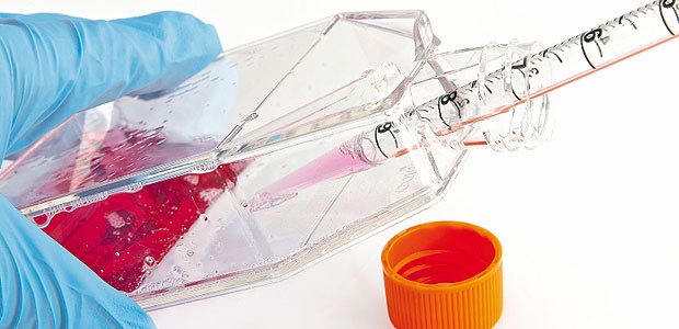 Bauanleitung für die Krebs-Killer Die Verjüngung von Zellen für eine künftige therapeutische Anwendung macht weiter große Fortschritte: Inzwischen lassen sich nach einer solchen Reprogrammierung Killerzellen herstellen, die ganz spezifisch gegen Melanomzellen gerichtet sind und sich in speziellen Nährflüssigkeiten vermehren lassen.