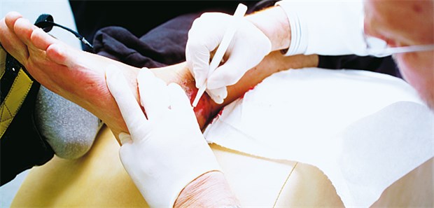Kniffliges bei Wunden und Verbänden Die Versorgung von Wunden ist medizinisch oft nicht einfach, aber auch bei der Abrechnung alles andere als trivial.