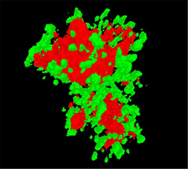 Amyloid hilft HIV Die Viren (grün) kleben an Samenzellen (rot).