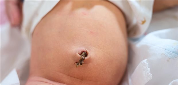 Die Wissenschaftlerinnen und Wissenschaftler, unter Leitung von Anup C. Katheria resümieren, dass in Verbindung mit den zuvor berichteten kurzfristigen Vorteilen die Ergebnisse dieser Folgestudie darauf hindeuten, dass das Melken der Nabelschnur eine gut durchführbare Intervention ohne längerfristige neurologische Entwicklungsrisiken ist.