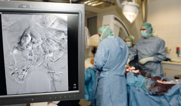 Die Zahl der Patienten mit Koronarstents nimmt stetig zu. Etwa 5 Prozent der Patienten müssen im ersten Jahr nach der Stentimplantation wegen nichtkardialer Ursachen operiert werden.