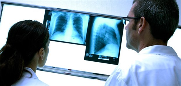 Mehr Tuberkulose-Fälle in Deutschland Die Zahl der Tuberkulose-Erkrankungen in Deutschland ist wieder am Steigen.