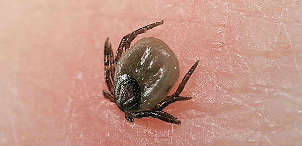 Die Zecke sticht offenbar gern in den Bauch- und Brustbereich des Menschen.
