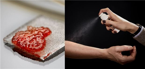 Die antimikrobielle Peptiden, die an Hydrogelpartikel gebunden sind, wirken selbst bei Kontakt mit Körperflüssigkeiten wie Blut. Als Spray können sie direkt in Wunden gesprüht oder als Beschichtung auf Katheter und Implantate aufgetragen werden.