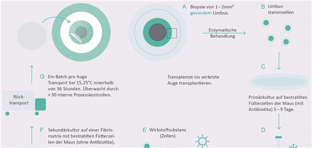 Die aus dem intakten Limbus bioptisch gewonnenen autologen Limbusstammzellen werden im Labor kultiviert. Auf einer Fibrinmatrix bildet sich das autologe Hornhautepithel-Transplantat, das in die verletzte Hornhaut transplantiert wird. Chiesi