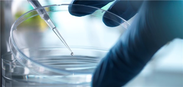 Die autologe Stammzelltransplantation wird MS-Kranken bislang meist nur als Ultima Ratio angeboten.