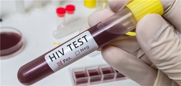 Röhrchen mit Blut für einen HIV-Test.