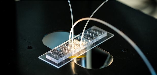 Deutsche Forschung will mit Berliner Zellklinik hoch hinaus Die einzelnen aus dem Gewebe isolierten Zellen werden zur Analyse in miniaturisierte Chips geschleust.